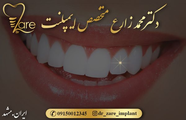 متخصص ایمپلنت