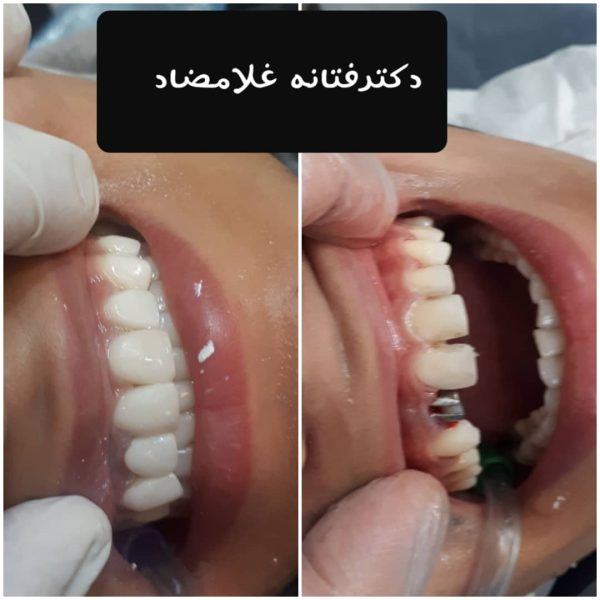 برترین کلینیک دندانپزشکی یزد | تبسم رویایی - Image 4