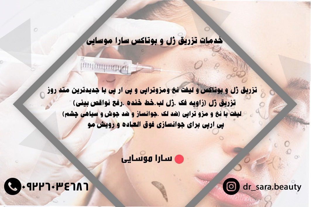 تزریق ژل و بوتاکس سارا موسایی در اصفهان