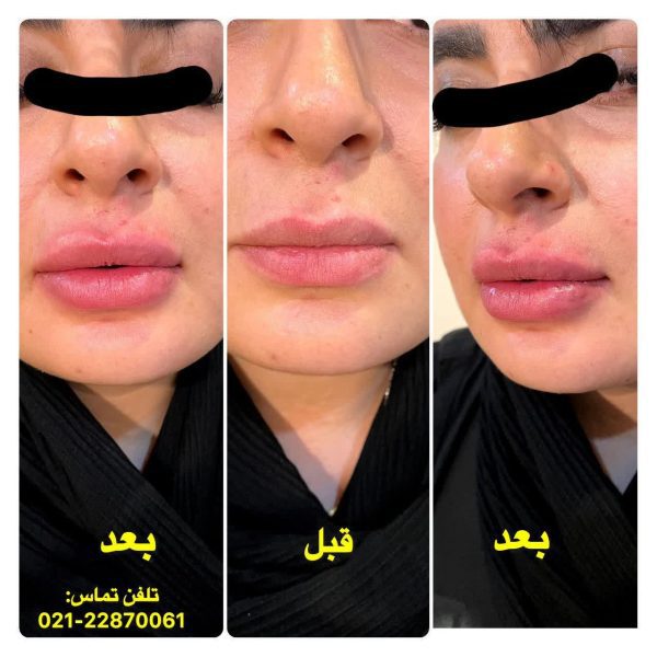بهترین کلینیک زیبایی ماه طلایی در میرداماد - Image 2