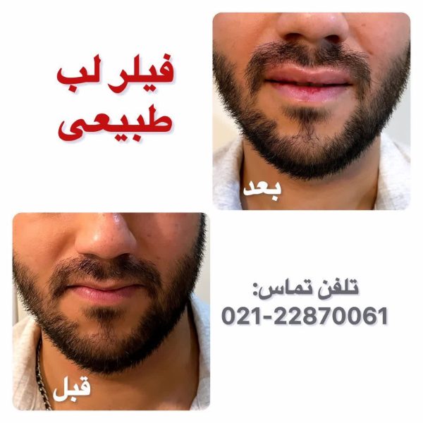 بهترین کلینیک زیبایی ماه طلایی در میرداماد