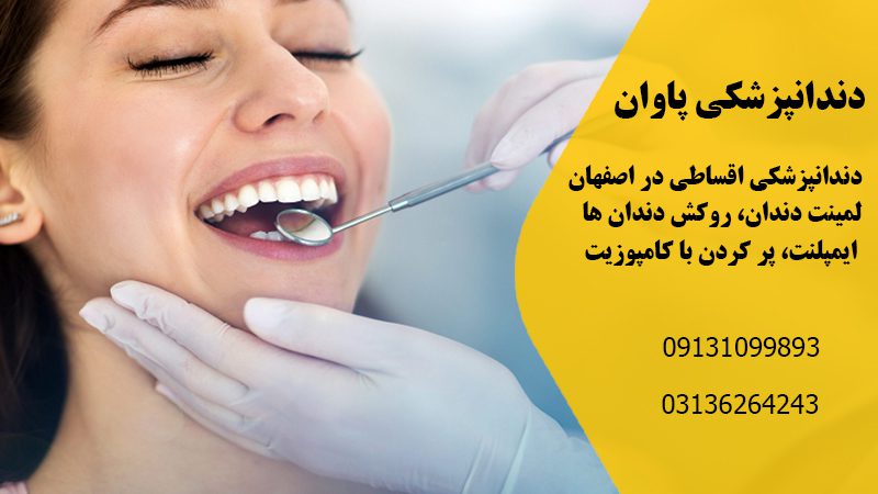 دندانپزشکی اقساطی در اصفهان | کلینیک دندانپزشکی پاوان