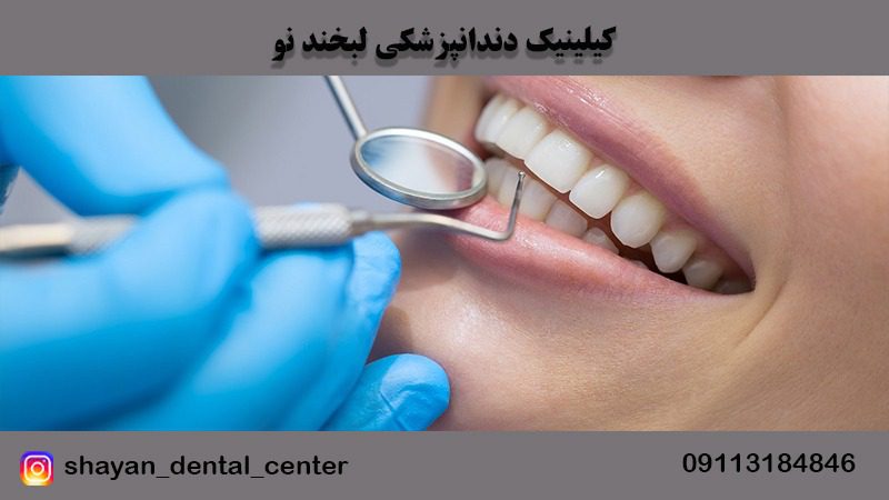 خدمات زیبایی و پروتز دندان در مازندران | کیلینیک دندانپزشکی لبخند نو
