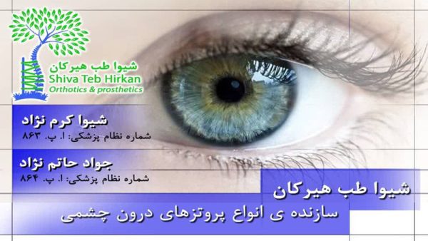 پروتز زیبایی چشم در شیراز | کلینیک ارتوپدی فنی شیوا طب هیرکان