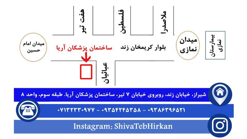 پروتز زیبایی چشم در شیراز | کلینیک ارتوپدی فنی شیوا طب هیرکان